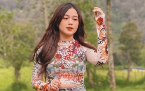 Brisia Jodie Pamer Sederet OOTD dengan Lutut Masih Diperban, Dipuji Tetap Cantik