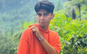 Dimas Ahmad Mendadak Jadi Pergunjingan, Penampilan Pakai Penutup 'Mata Satu' Ini Ramai Diingatkan