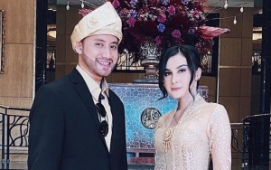 Kevin Aprilio Ternyata Transplantasi Rambut demi 'Imbangi' Wajah Istri