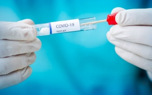 COVID-19 di 33 Provinsi RI Turun, Ternyata Imbas Jumlah Tes Harian Ikut Berkurang?