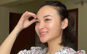 Kenang Momen Saat Depresi, Revina VT Bagikan Potret Dirinya Usai Iris Pergelangan Tangan 