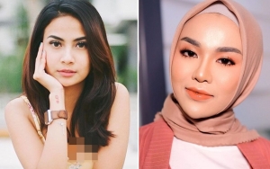 Dituding Biang Kerok, Vanessa Angel Bantah Sebar Chat Soal 'Tas KW' Medina Zein