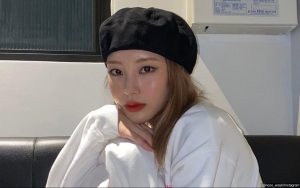 Masa Lalu Noze WAYB Dibongkar Sesama Dancer 'Street Woman Fighter', Cantik Sejak Sekolah?