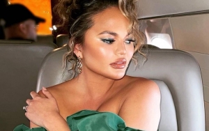 Chrissy Teigen Akui Jalani Bedah Wajah Untuk Hilangkan Lemak Di Pipi, Tuai Respons Negatif?