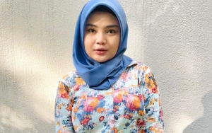 Rosa Meldianti Akui Operasi Hidung, Hasil Natural Habiskan Biaya 60 Juta