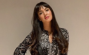 Aurelie Moeremans Minta Fans Tenang Usai Bagikan Foto dengan Mata Sembab, Gercep Beber Faktanya
