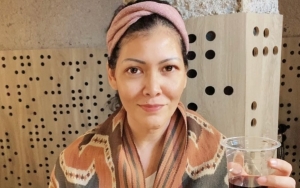 Melanie Subono Jalani Operasi, Ternyata Sudah 20 Tahun Lebih Idap Sakit Ini