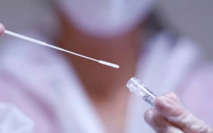 Epidemiolog Heran Wajib Tes COVID-19 Pakai PCR Sebelum Naik Pesawat: Padahal Relatif Aman