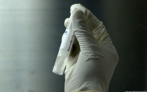  Jelaskan Struktur Harga Tes PCR, Bio Farma Tegaskan Rp90 Ribu Hanya Untuk Reagen Kit