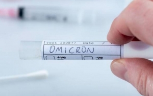 Omicron Diduga Bukan Evolusi Varian Delta Namun Berasal dari Pasien HIV