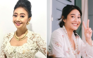 Heboh Lagi Cerita Asri Welas Pernah Jadi 'Kaki' Dian Sastro, Respons Suami Mengejutkan
