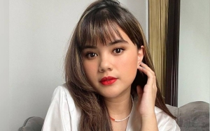 Audi Marissa Ungkap Penyebab Pipi Kanan-Kiri Bengkak, Foto Gemas Bak 'Chipmunk' Dipuji Tetap Cantik