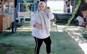 Capek Ditanya, Rahmawati Kekeyi Kembali Jelaskan Alasan Gak Pakai Behel