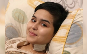 Fakta Baru, Rambut Bondol Laura Anna Ternyata Ulah Tangan Ibunda Gaga Muhammad