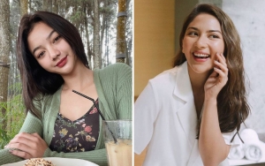 Foto Terbaru Glenca Chysara Bikin Pangling, Disebut Beda Hingga Dikira Jessica Mila