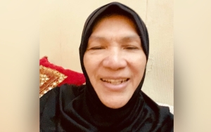 Selain Badan Kurus, Dorce Gamalama Alami Pembengkakan Kaki Selama Rawat Jalan