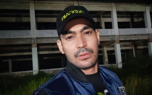Operasinya Berhasil, Robby Purba Perlihatkan Penampakan Tumor Payudaranya yang Sudah Diangkat