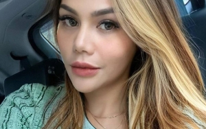 Kondisi DJ Katty Butterfly Buat Publik Prihatin Usai Pamer Hasil Kerokan 'Tak Wajar' Ke Sosmed
