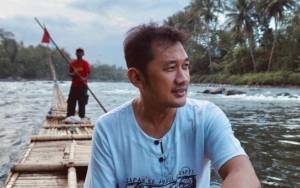 Hanung Bramantyo Ungkap Risiko Operasi Saraf Kejepit, Sarankan Ini Untuk Jaga Kesehatan