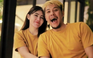 Via Vallen Komentari Hidung 'Calon Anak', Paras Rupawan Disorot