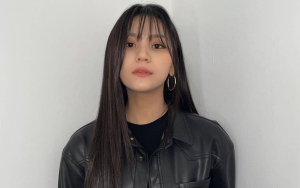 Umji VIVIZ Dikonfirmasi Positif COVID-19, Agensi Beber Alami Gejala Ringan