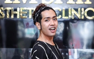Dulunya Makan Nasi Basi Hingga Dimaki Kasar, Curhatan Pilu Kim Hawt Bikin Nyesek