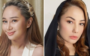 Denise Chariesta Makin Nantang Unggah Foto Fosil Usai Emma Waroka 'Main Keroyokan'