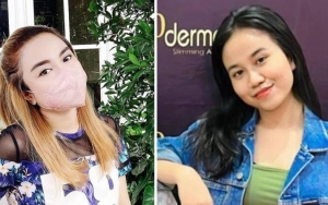 Lepas Hijab, Wajah Medina Zein Disebut Mirip Plek Ketiplek dengan Mayang?