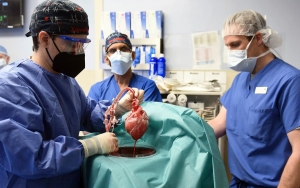Orang Pertama di AS yang Terima Transplantasi Jatung Babi Meninggal Dua Bulan Setelah Operasi