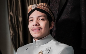 Sempat Transplantasi Rambut, Penampilan Baru Atta Halilintar Kini Curi Perhatian