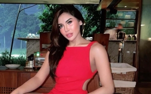 Millendaru Pamer Hasil Usai Face Contouring Malah Disebut Seram