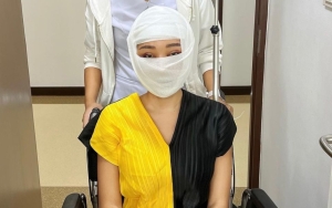 Lucinta Luna Siap Perlihatkan Wajah Baru, Perjuangan Menyakitkan Pasca Operasi Bikin Merinding