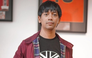 Mata Lebam Parah, Rian D'Masiv Tetap Manggung Usai Kecelakaan Banjir Ucapan Doa