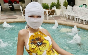 Kenakan Dress Hingga Kepala Masih Diperban, Cara Lucinta Luna Bangunkan Sahur Malah Bikin Kaget