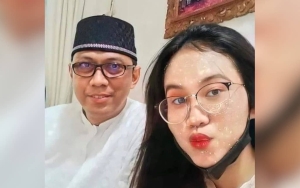 Doddy Sudrajat Ungkap Mayang Bakal Pasang Behel, Kesal Sering Dihujat Soal Gigi? 