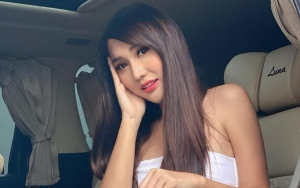 Lucinta Luna Tulis Pujian Selangit Usai Akhirnya Buka Perban di Wajah, Digeruduk Pertanyaan Ini