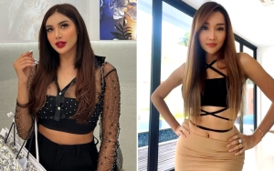 Wajah Millendaru Mendadak Disebut Aneh, Dituding Ikut Lucinta Luna Oplas Ganti Kepala