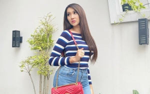 Demi Cantik, Cerita Lucinta Luna Rela Tulang Pipinya Dikikis Bikin Ngeri