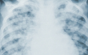 Jasa Pembersihan AC di Thailand Kebanjiran Order Gara-gara Pernyataan Depkes Soal Ancaman Pneumonia