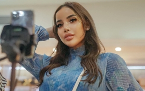 Adu Cantik Dengan Arsy Hermansyah, Wajah Millendaru Disebut Beda Langsung Jadi Gunjingan