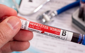 Kasus Hepatitis Akut Misterius Bisa Serang Orang Dewasa? Ini Kata IDAI dan Kemenkes