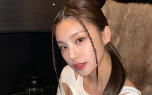 Anti Bibir Kering, Yeji ITZY Beber Tips Lakukan Tahapan Penting Ini Demi Tampil Stunning