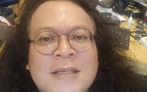 Musisi Doddy Katamsi Dirawat Di RS Alami Pembengkakan dan Jantung Bocor