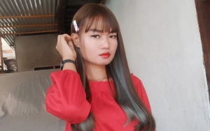Seleb TikTok Popo Barbie Nekat Oplas Hidung Demi Tampil Cantik?