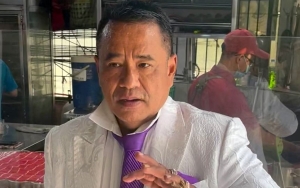 Dikira Jadi Pengacaranya Dokter Richard Lee, Hotman Paris: Saya Cuma Mau Ambil Alih Perusahaan Dia