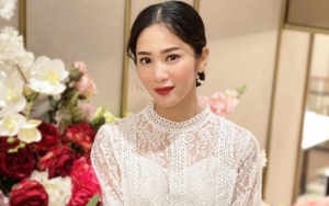 Bunga Zainal Tanggapi Begini Saat Disebut Tambah Cantik: Kata Netijen Loh