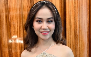 Bukan Lagi Isu, Mayang Akui Sudah Diterima Kuliah Kedokteran Gigi di Universitas Ternama