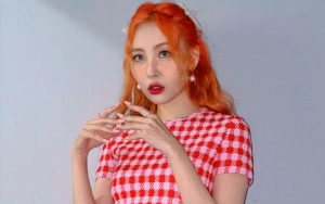 Sunmi Tutupi Memar di Bagian Lutut Pakai Produk Make Up 