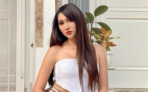 Ngefans Berat, Lucinta Luna Pamer Bibirnya Kini Mirip Jisoo BLACKPINK