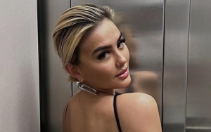 Bikin Khawatir, Inikah Penyebab Agnez Mo Tampak Kurusan dan Pucat di Foto Terbaru?